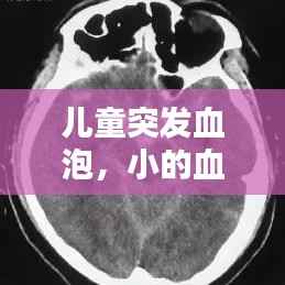 儿童突发血泡,小的血泡